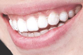 前牙开颌有哪些不利因素