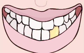 中年人能做牙齿矫正吗
