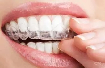 牙套